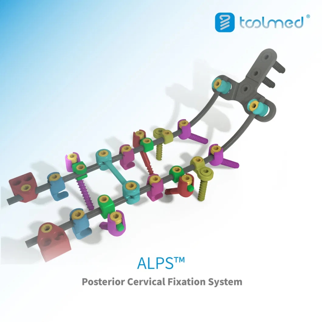 Alps-trade-Posterior-Cervical-Fixation-System-Titanium-Orthopedic-Surgical-Implant-for-Spine-Surgery-CE-ISO-Certified.webp.jpg
