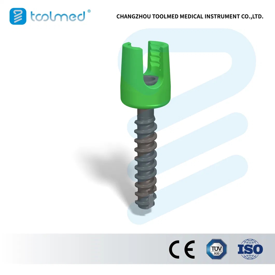 Alps-trade-Posterior-Cervical-Fixation-System-Titanium-Orthopedic-Surgical-Implant-for-Spine-Surgery-CE-ISO-Certified.webp (1).jpg
