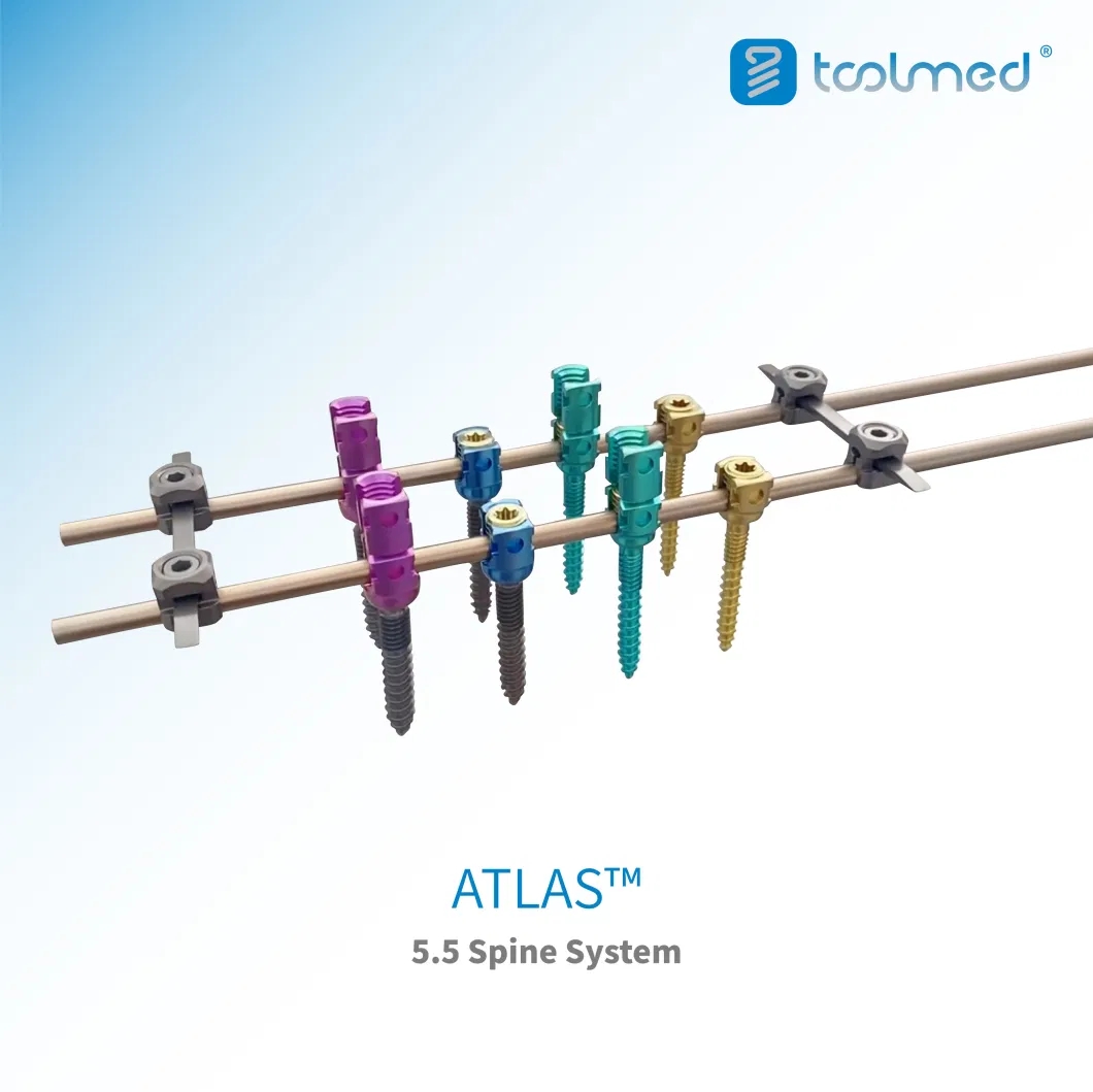 Atlas-trade-5-5-Posterior-Thoracolumbar-Spinal-System-Titanium-Orthopedic-Implant-for-Spine-Surgery-CE-ISO-Certified.webp.jpg