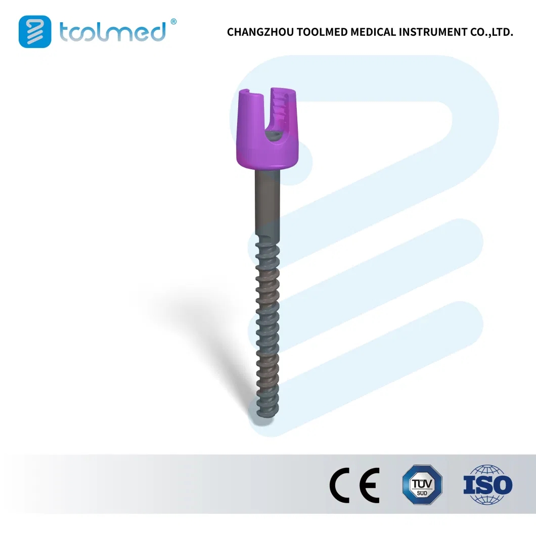 Alps-trade-Posterior-Cervical-Fixation-System-Titanium-Orthopedic-Surgical-Implant-for-Spine-Surgery-CE-ISO-Certified.webp (2).jpg